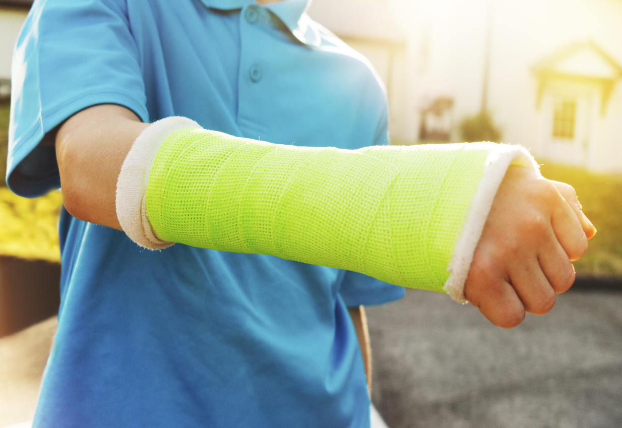 young boy with a broken arm in a cast